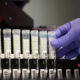 What to know about the spread of the bird flu