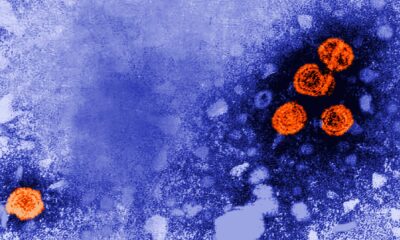 Trump admin awards hepatitis B vaccine contract to Europeans working in Guinea-Bissau