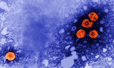 Guinea-Bissau suspends Trump-backed hepatitis B vaccine study for ethical review