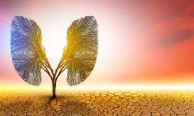 Repeal of EPA’s endangerment finding won’t change the realities of chronic disease
