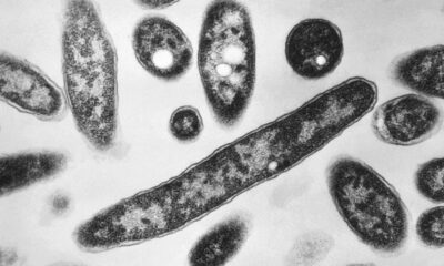 Legionnaires’ cluster grows in New York City: Health Department