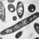 Legionnaires’ cluster grows in New York City: Health Department