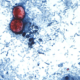 Cyclospora cases mounting in Michigan